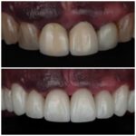 WhatsApp Image 2022-10-08 at 1.58.08 PM (3)